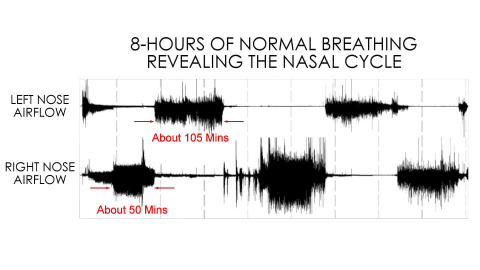 Patient 8 hour nasal cycle Dynaris
